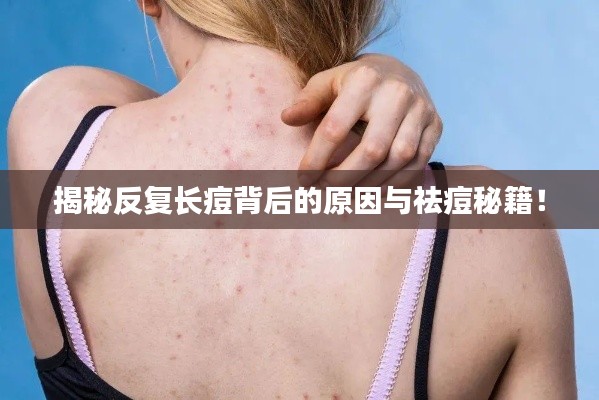 揭秘反复长痘背后的原因与祛痘秘籍!